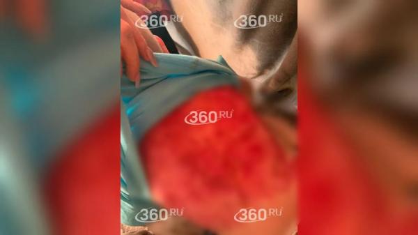 Стаффордширский терьер напал на&nbsp;двоих детей, пока их&nbsp;мать была на&nbsp;свидании
